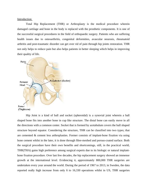 Total Hip Replacement Assignment
