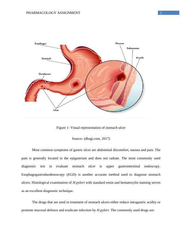 Gastric Ulcers: Mucosal Lesions in Upper Gastrointestines_3