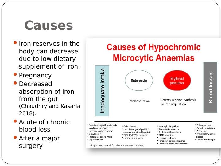 Hypochromic Microcytic Anemia: Causes, Pathogenesis, and Diagnostic Approaches_3