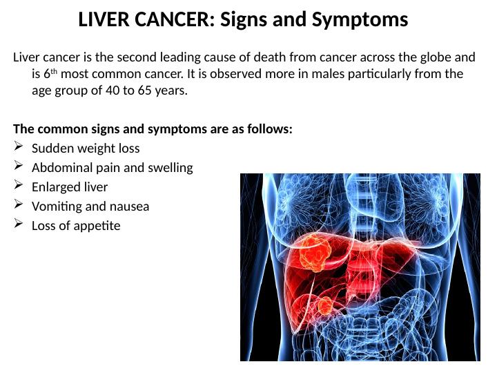 Liver Cancer: Signs and Symptoms_2