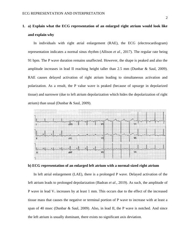 Article | ECG REPRESENTATION AND INTERPRETATION