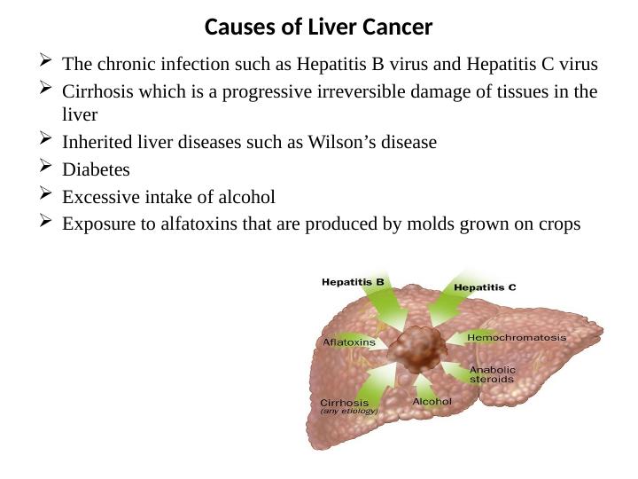 Liver Cancer: Signs and Symptoms_3