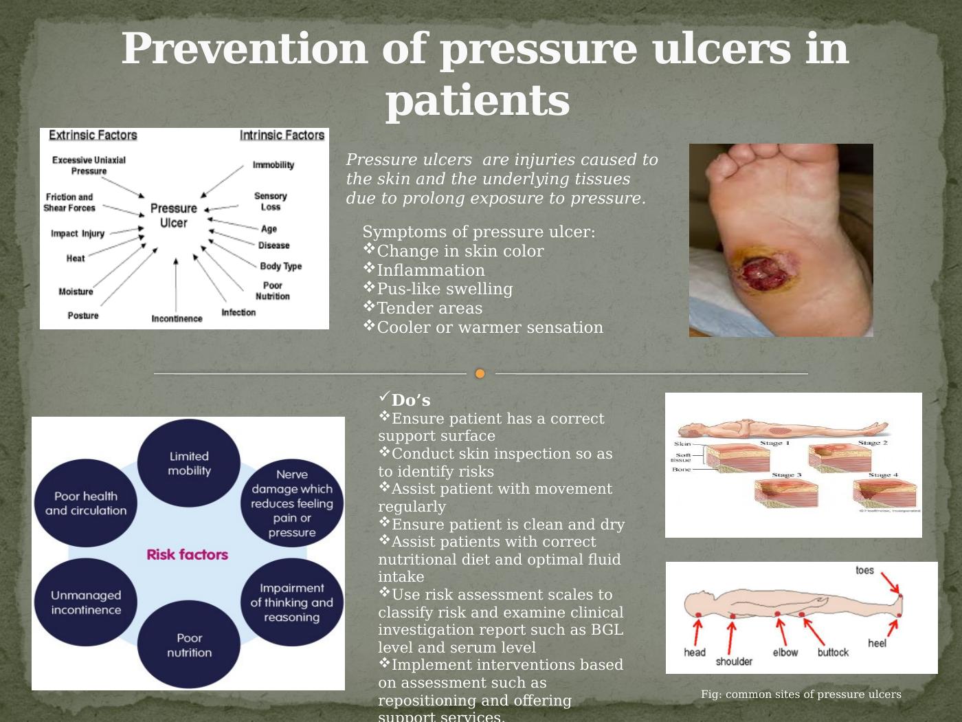 Prevention of pressure ulcers in patients Pressure ulcers are