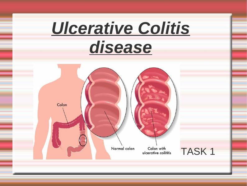 Ulcerative Colitis: Disease and Significance in Australia