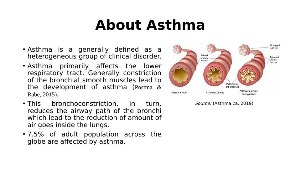 Disease condition: Asthma | Assessment