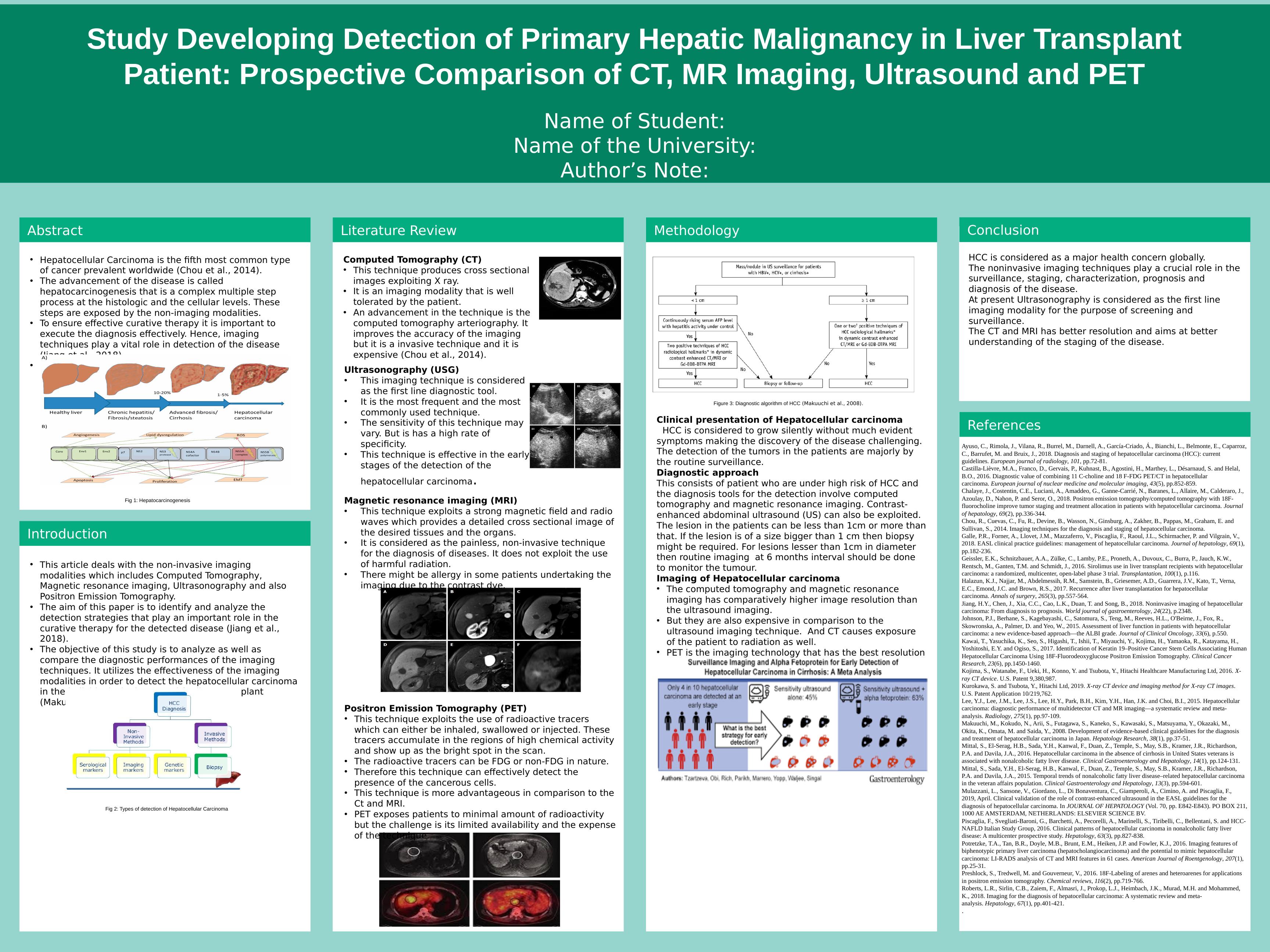 Detection of Primary Hepatic Malignancy in Liver Transplant Patient: Comparison of CT, MR Imaging, Ultrasound and PET_1
