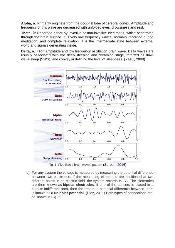 Electroencephalogram (EEG): Fundamental, Measurement Process and Implementation of Digital Filter in MATLAB_4