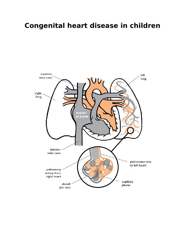 Congenital Heart Disease in Children : Report_1