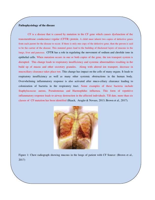 Cystic Fibrosis: Fact Sheet Articles 2022_3