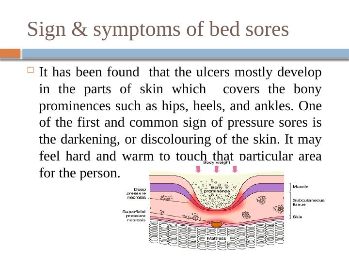 Preventing Pressure Sores: Education and Interventions for Clinicians and Patients_3