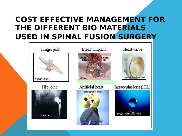 Cost Effective Management for Different Biomaterials Used in Spinal Fusion Surgery_1